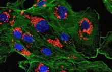 Polimerowe nanocząsteczki mogą zapobiec odrzutowi przeszczepionego organu