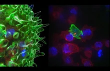 Nauka: Poznajcie niszczyciela raka. Killer T Cell.