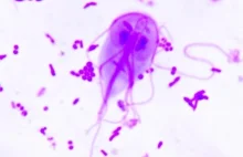 Potwory w nas: ogoniastek jelitowy czyli Giardia lamblia (duodenalis)