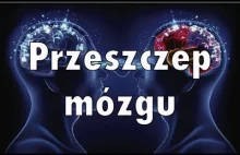 Kiedy sztuczne organy będzie można przeszczepiać?