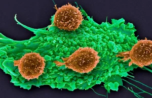 Cutting-edge CRISPR gene editing appears safe in three cancer patients