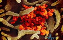Wyizolowano ważne białko nowego koronawirusa, torując drogę dla szczepionki