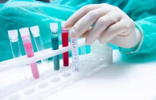 Koronawirus w Łodzi: Pierwszy test POTWIERDZA obecność wirusa! Premier...