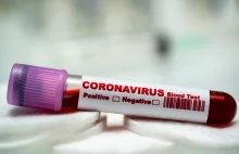 Koronawirus. W Singapurze zastosowano test specjalny serologiczny.