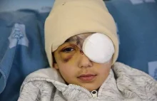 Palestyński chłopiec stracił oko po postrzeleniu przez izraelskiego...