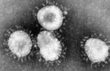 Pandemia koronawirusa pokazuje dziury w naszej wiedzy. Przyjrzyjmy się im!