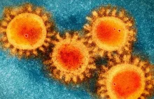 Koronawirus nie powstał w laboratorium, ma naturalne pochodzenie