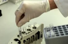 W 2013 rozpoczęto proces likwidacji laboratoriów przy powiatowych Sanepidach