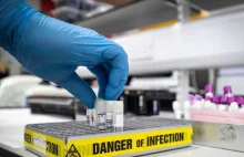 18 latek zmarł w UK na koronawirusa