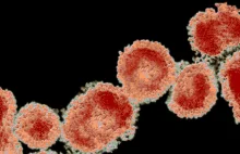 Historia o infekcji koronawirusem (The Story of a Coronavirus Infection)