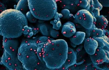 Zdjęcia z mikroskopu elektronowego pokazują, jak koronawirus „zabija” komórki.