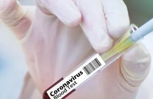 Testy na koronawirusa nie są robione nawet osobom z objawami