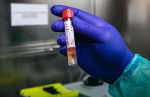 W regionie testy na koronawirusa nie są robione nawet osobom z objawami.