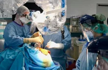 Neurochirurdzy ze szpitala MSWiA zoperowali tętniaka mózgu u pacjenta z COVID-19