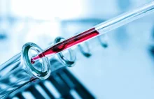 Polska firma wprowadzi do sprzedaży szybkie testy do wykrywania koronawirusa