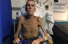 37 kilogramowy mężczyzna uznany za zdolnego do pracy umarł w szpitalu... [UK]