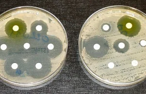 Czym jest antybiotykooporność i jak chronić antybiotyki?