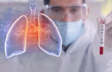 U połowy pacjentów z bezobjawowym przebiegiem COV19 stwierdzono uszkodzenie płuc