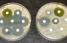 Oporność na antybiotyki poważnym zagrożeniem. Czym jest antybiotykooporność ?