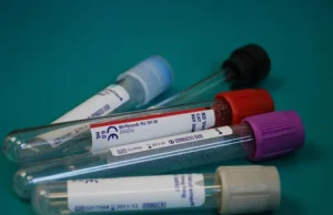 Francuski noblista: Koronawirus zawiera część materiału genetycznego wirusa HIV!