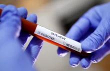 Polska Akademia Nauk pracuje nad masowymi testami na koronawirusa