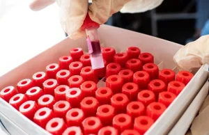 W Europie zatwierdzono test na przeciwciała koronawirusa. Jest skuteczny w 99%