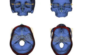 Cranial base