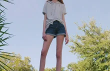 I’m 16 And Have The World’s Longest Legs