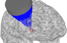 Ultradźwiękowa stymulacja mózgu bezpośrednio zmienia zachowanie małpy