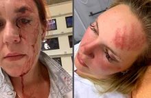 Szwecja: Dwie kobiety brutalnie pobite przez gang imigrantów w mieście Uppsala