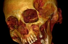 Badania tomograficzne pomagają rozwiązać zagadkę mumii krzyczącej kobiety.