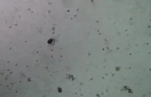 "Brudna woda" pod mikroskopem. (Gif Eng)