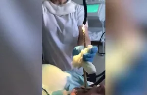 Lekarz wyciąga żywego węża z pacjentki.