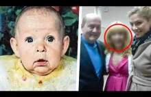 Ojciec zobaczył twarz swojego dziecka i natychmiast je porzucił!