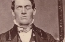 Phineas Gage – mężczyzna z czaszką przebitą przez pręt zrewolucjonizował naukę.