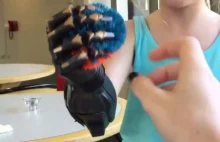 Bioniczna ręka - to dzieje się naprawdę.