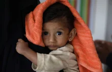 Jemen: poważny kryzys humanitarny [GALERIA