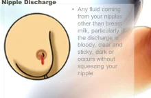 Is nipple secretions a sign of breast cancer?