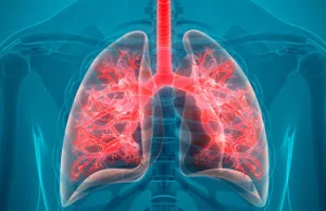 CBD może łagodzić stany zapalne płuc u chorych na koronawirusa