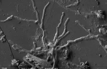 W zeszklonym mózgu ofiary Wezuwiusza znaleziono zachowane neurony.