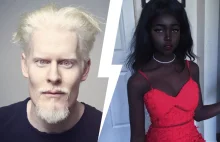 8 niezwykłych ludzi o wyjątkowym kolorze skóry | INTERNET HUCZY