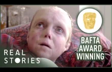 Człowiek, którego skóra odpadła (dokument z nagrodą BAFTA)