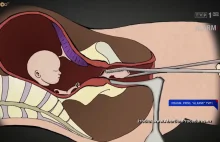 Animacja aborcji w TVP XD