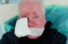 74-letni dziennikarz postrzelony przez policję na Marszu Niepodległości!