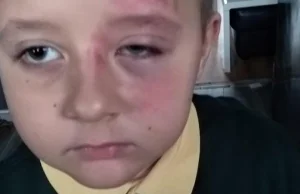 7-latek z Polski brutalnie pobity w szkole. "Za to tylko, że jest Polakiem"