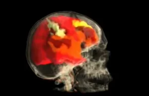 Film, który przedstawia mózg kobiety podczas osiągania orgazmu