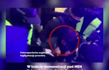 Grzybowska próbuje trwale uszkodzić wzrok policjanta