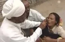 Dentysta w Indiach