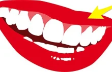 Jak Usunąć Kamień Nazębny Bez Dentysty? Oto Instrukcja