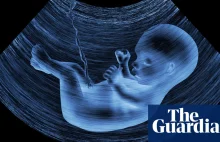 Microplastics revealed in the placentas of unborn babies